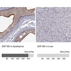 ZNF185 Antibody, Novus Biologicals 25 &mu;L; Unlabeled:Antibodies, Polyclonal